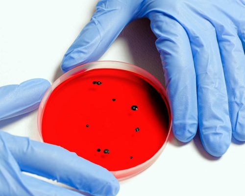 Imagecelluletanycyte