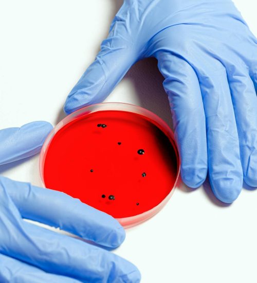 Imagecelluletanycyte